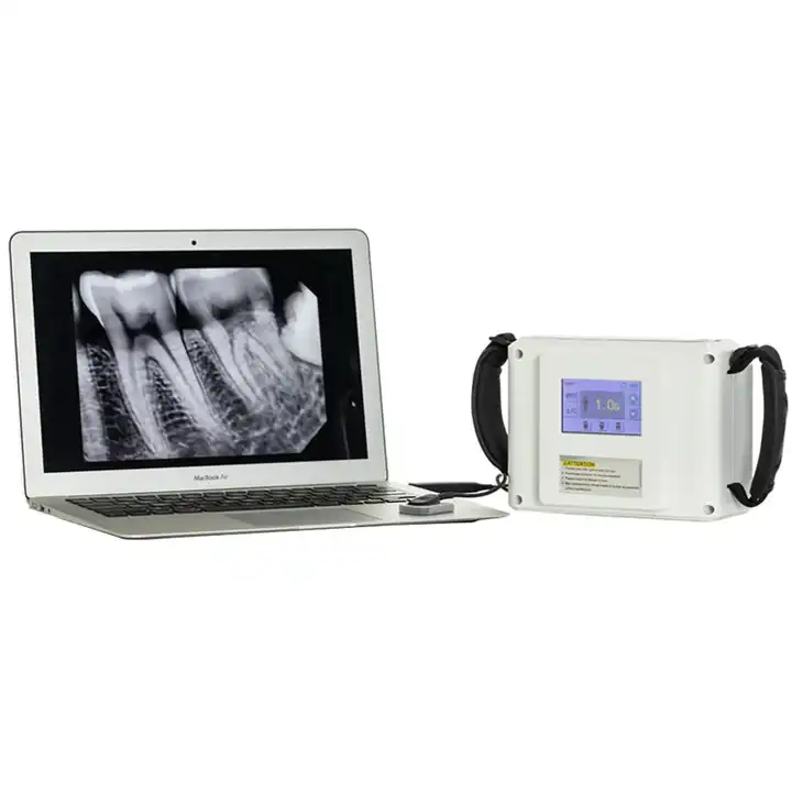 Unidad de rayos X digital dental de alta frecuencia con pantalla LCD